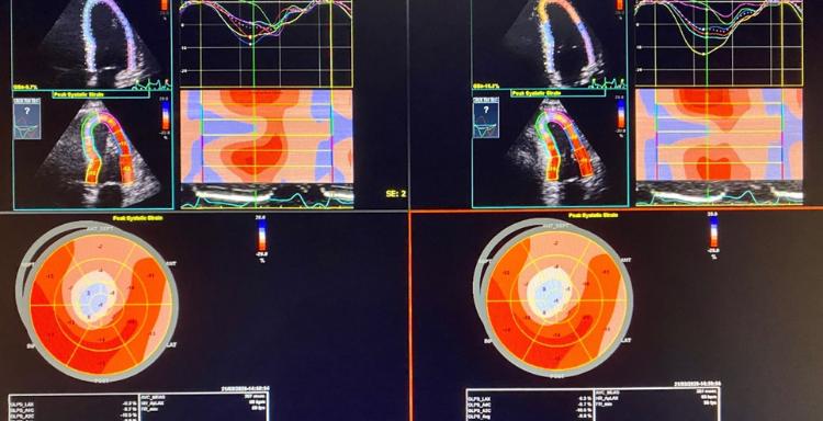 Μυοκαρδιοπάθειες