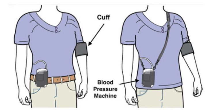 Ηolter αρτηριακής πίεσης